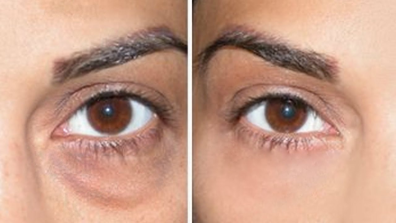 How to Cover Dark Circles + Under Eye Bags